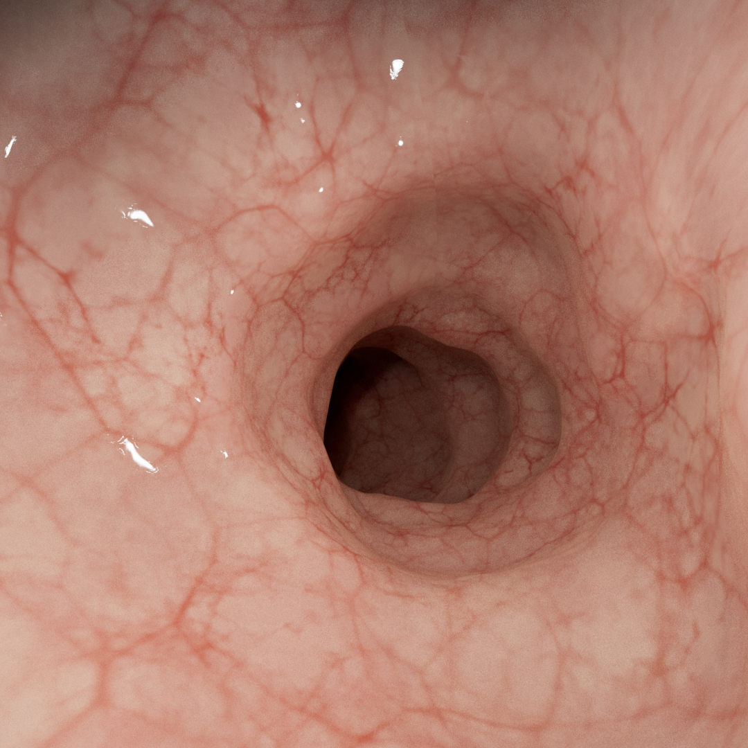 Darmschleimhaut ohne Entzündung (Mukosaheilung)